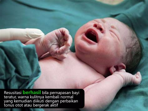 cara menghilangkan cegukan pada bayi baru lahir 4