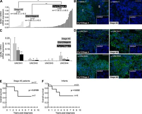 Netrin 1 Up Regulation Is Detected In Aggressive Nb A Netrin 1 Mrna