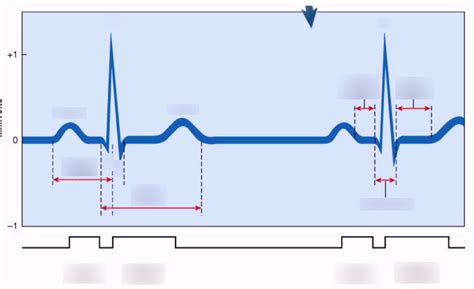 Labeling Ecg Strip Diagram Quizlet