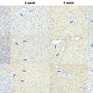 Immunohistochemical Staining Of Cd In Each Wound Group