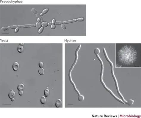 Germ Tube Test Principle Procedure Results • Microbe Online