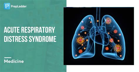 Acute Respiratory Distress Syndrome Pathophysiology