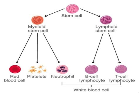 Chronic Myeloid Leukemia: Causes, Symptoms & Treatment