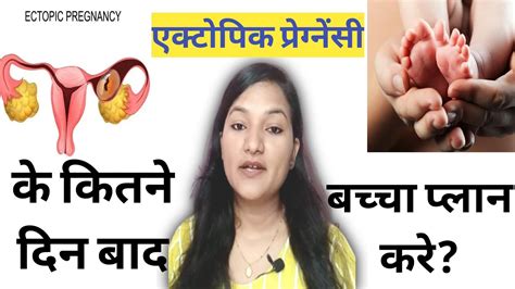 Ectopic Pregnancy Ke Baad Pregnancy Plan Kab Kare Pregnancy Planning