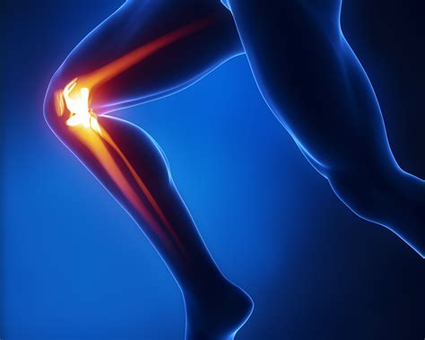 Top Knee Pain Doctor Bay Ridge Brooklyn Physical Therapy For Knee