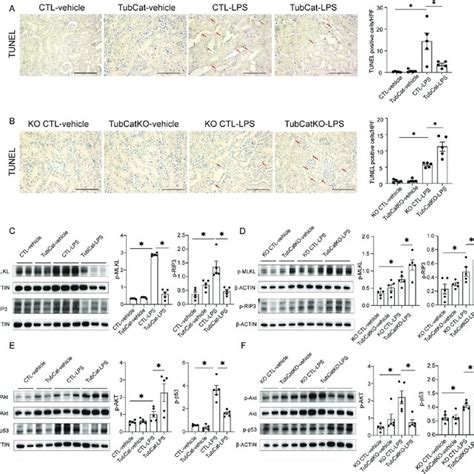 β Catenin Reduces Kidney Cell Death In Lps Induced Aki Via Aktp53