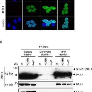 Sumoylation Does Not Affect DRIL1 Localization A Immunofluorescence