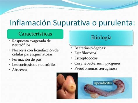 Tipos De Inflamación