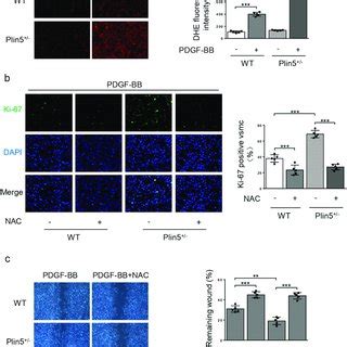 Plin Knockdown Causes Increased Vsmc Proliferation And Migration