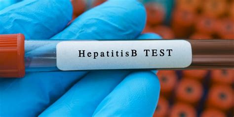 Can Hepatitis B Test Be False Positive: Unraveling the Truth ...