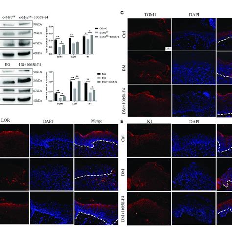 Inhibition Of C Myc Transcription Activity Alleviates The