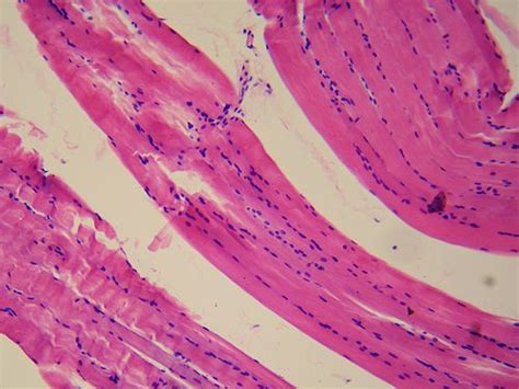 Smooth muscle tissue | Wiki | Everipedia