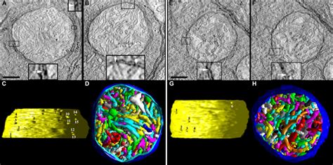 Control Spherule And Pedicle Mitochondria Possess Many Cristae Cristae Download Scientific