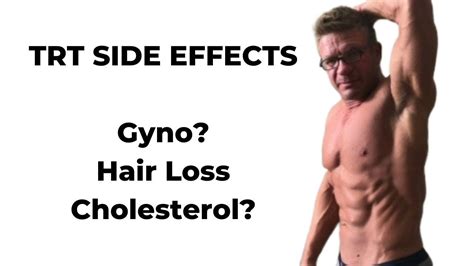 The Side Effects Of Testosterone Replacement Therapy TRT YouTube