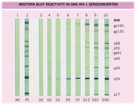 Laboratory diagnosis of HIV Infection • Microbe Online