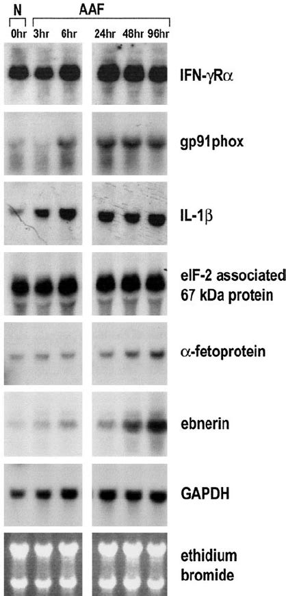 Northern Blot Analysis Of Genes Identified By Suppression Subtractive