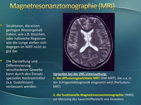 Hirn CT MR Tumoren Störungen der Blutversorgung ppt herunterladen