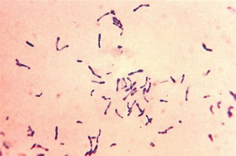 19+ Commensal Bacteria Examples: Detailed Explanations And Images ...