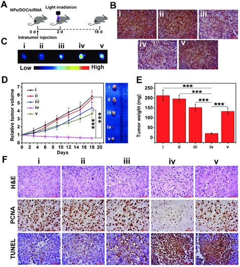 In Vivo Antitumor Effects Of Our Nps Doc Sirna Towards Mcf Adr