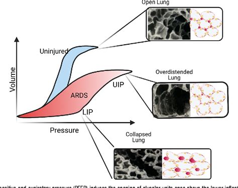 Figure 2 From Ventilator Associated Lung Injury Semantic Scholar