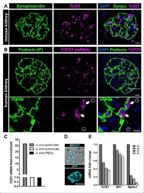 Tcf21 Expression In Mouse Kidney And Cell Culture A Expression Of