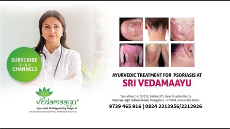 Best Ayurvedic Psoriasis Treatment A Guide For Patients Kannada Sri Vedamaayu Dr