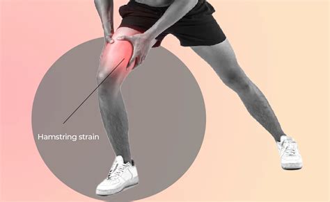 Hamstring Strain Curezone Physiotherapy