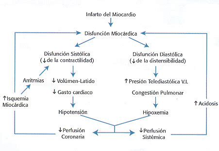 shock cardiogenico