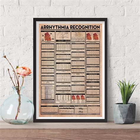 Arrhythmia Recognition Poster Heart Disease Print Cardiologist Office