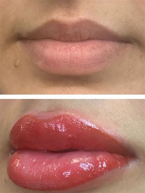 Lip Blush Tattoo Permanent Makeup Natural Enhanced Beauty Clinic Leeds