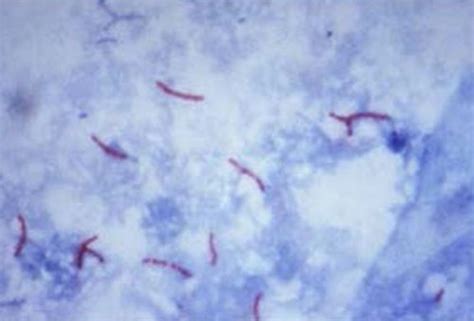 Acid Fast Bacillus AFB Histocenter