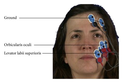 Locations Of The Emg Electrodes Download Scientific Diagram