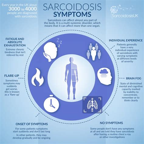 Sarcoidosis Infographics - SarcoidosisUK