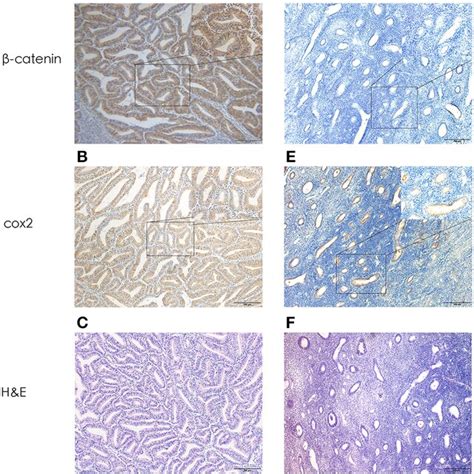 Representative Photomicrographs Of Immunohistochemistry A β Catenin Download Scientific