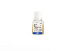 Human Type AB Serum HCV HIV HBsAG Heat Inactivated MP Biomedicals