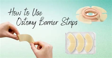 How To Use Ostomy Barrier Strips Personally Delivered Blog