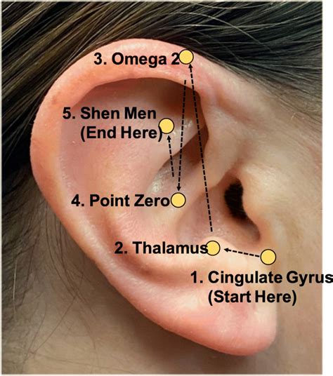 The Effectiveness Of Battlefield Acupuncture In Addition To Standard