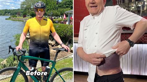 Lucky To Be Here Gordon Ramsay Reveals Brutal Injury After Bike