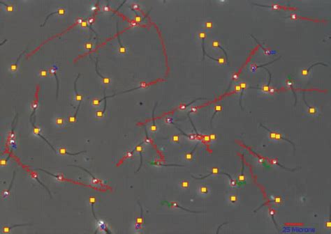 Diagnostic Semen Analysis Basicmedical Key