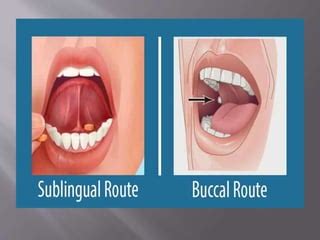 DRUG ADMINISTRATION THROUGH ENTERAL ROUTE.pptx