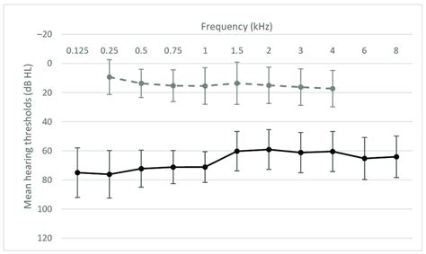 Air Conduction Thresholds Black Solid Line And Bone Conduction Download Scientific Diagram