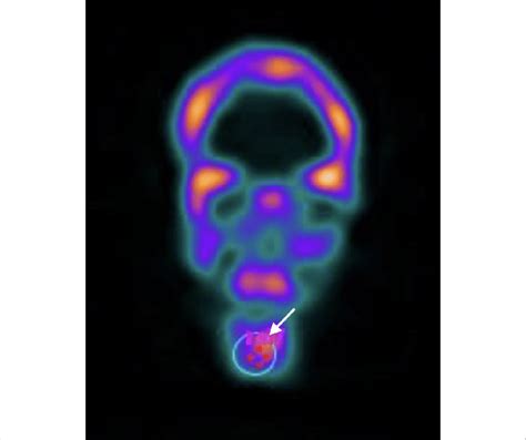 The regions of interest were examined on the coronal slice of the ...