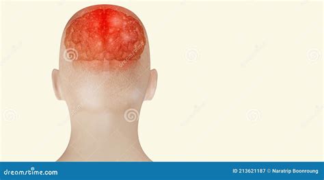 Headache Brain System Problems Skull Pain Face Man Showing Headaches D