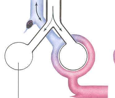 Lung Ventilation And Perfusion Flashcards Quizlet