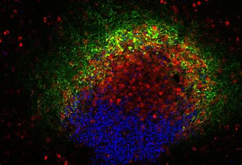 Germinal Center IMAGE EurekAlert Science News Releases