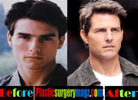 Tom Cruise Nose Job Before And After | | Plastic Surgery Magazine