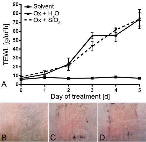 Effects Of AHAPS SiO2 NP Treatments On Barrier Function And Erythema