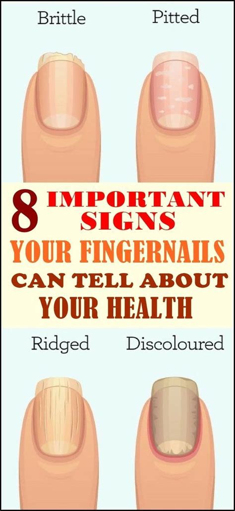 What These 8 Fingernail Signs Say About Your Health Fingernails