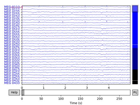 Overview Of Meg Eeg Analysis With Mne Python Mne Documentation