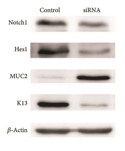 Effects Of Notch Signaling Inhibition Expressions Of Notch Hes And